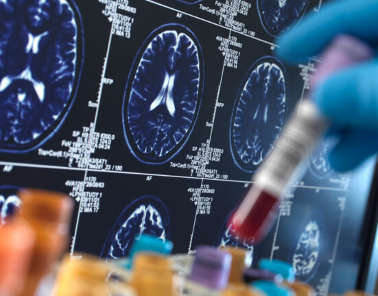 A vial of blood is put into a tube rack, with medical images of a brain in the background.