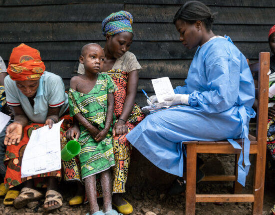 Battling Mpox in the Outbreak’s Epicenter in Congo