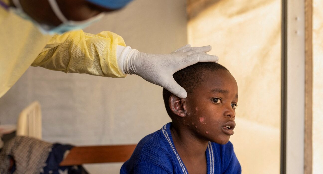 Sweden confirms first case of mpox strain outside Africa | Health News